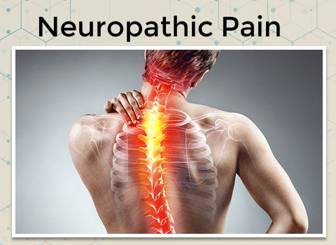 Neuropathic Pain