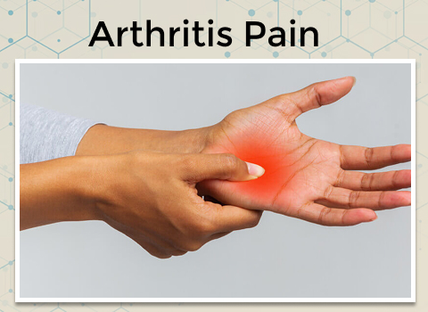 Arthritis Pain